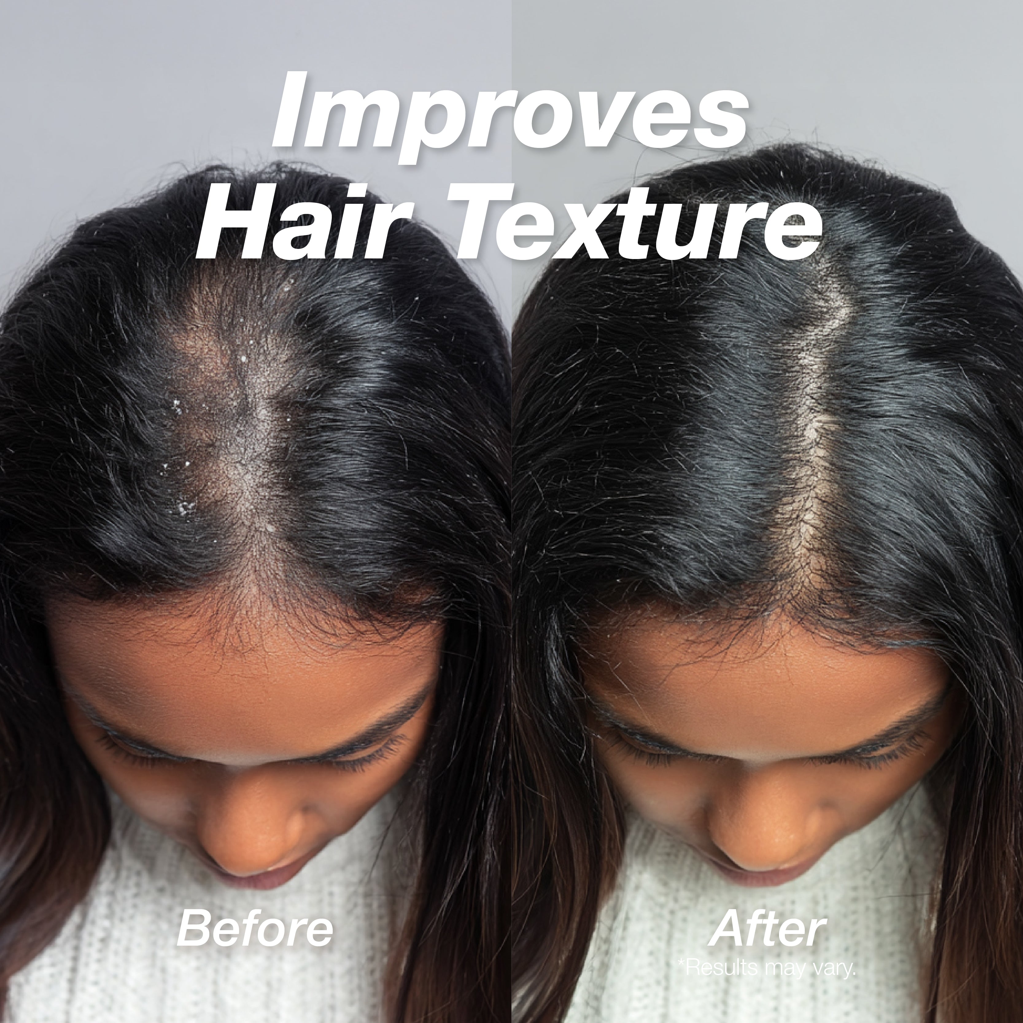 Scalp Therapy - Tea Tree